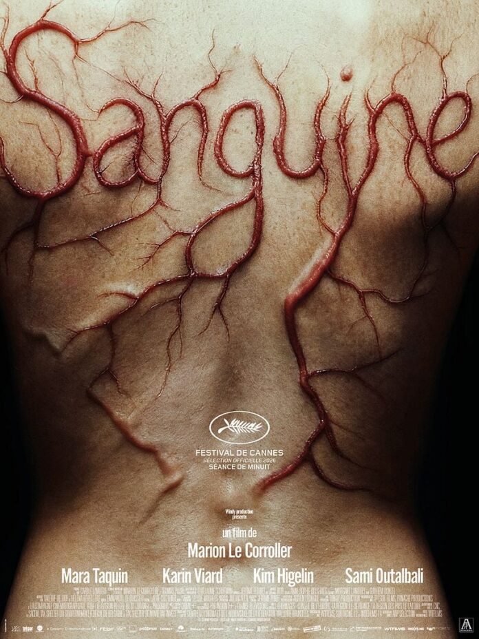 Sanguine